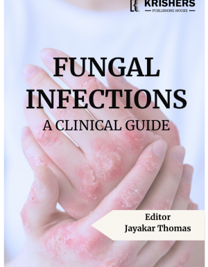 Fungal Infections – A Clinical Guide